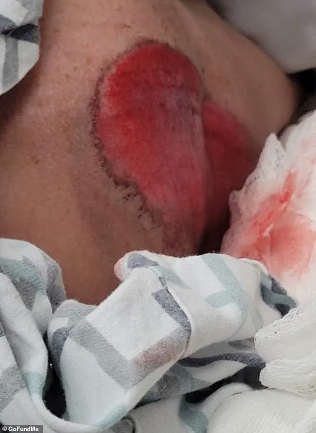 Collision Between Scooter and Vehicle Injures Student in Kaukauna, Wisconsin