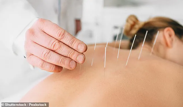 Acupuncture Shows Long-Term Relief for Chronic Back Pain in Landmark Study