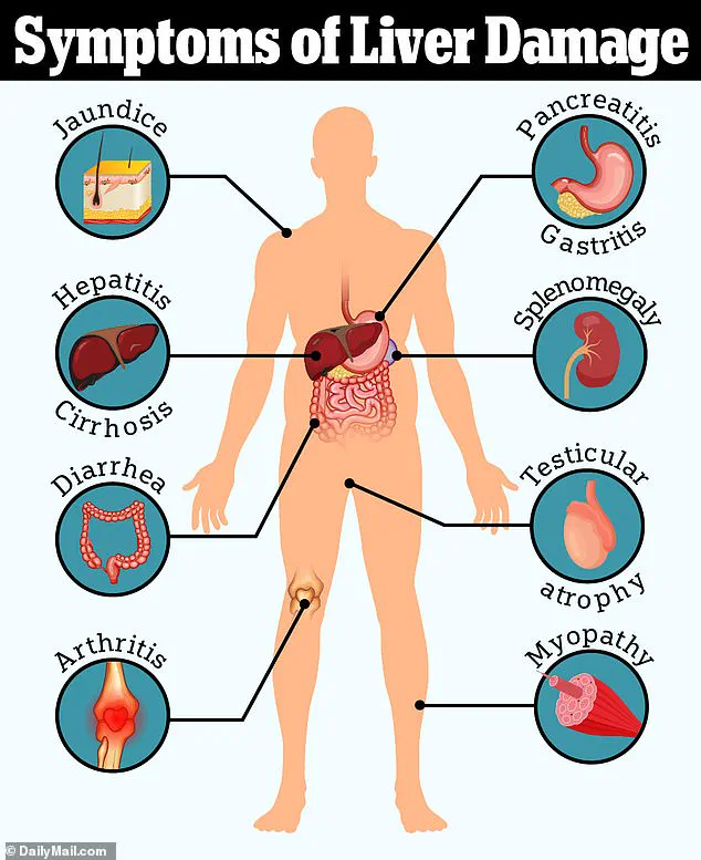 Silent Health Crisis: 80 to 100 Million U.S. Adults May Live with Undiagnosed Fatty Liver Disease