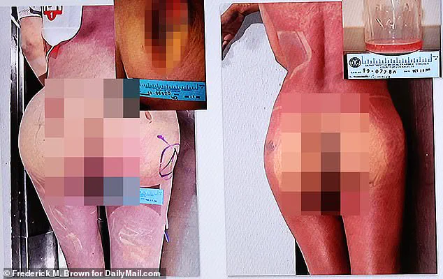 Behind Closed Doors: The Exclusive Access and Medical Secrets Behind the 'Butt Lady' Conviction