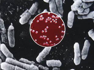 Public health officials warn of unprecedented rodent surge and rising plague risk in U.S. as travelers urged to exercise caution