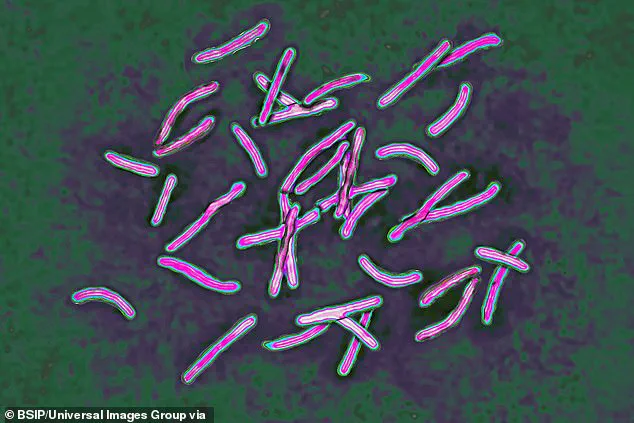 Health Officials Warn of TB Resurgence as Cases Surge 13.6% in England
