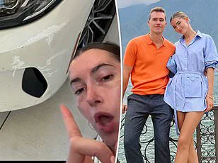 Influencer Faces Public Outcry After Celebrating Birthday with Contagious Pink Eye, Raising Concerns Over Health Risks