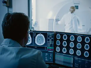 Urgent Warning: Sundowning in Dementia Patients Demands Immediate Caregiver Attention