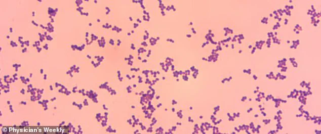 Deadly Threat of Normally Harmless Bacteria Sparks Rising Concerns Over Group G Streptococcus Infections