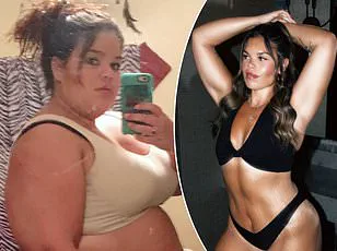 Limited Access: The Elusive Path to Weight Loss Surgery for the Privileged Few