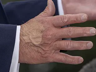 Public Health Experts Sound Alarm Over Trump's Long-Term High-Dose Aspirin Regimen, Citing Defiance of Medical Advice