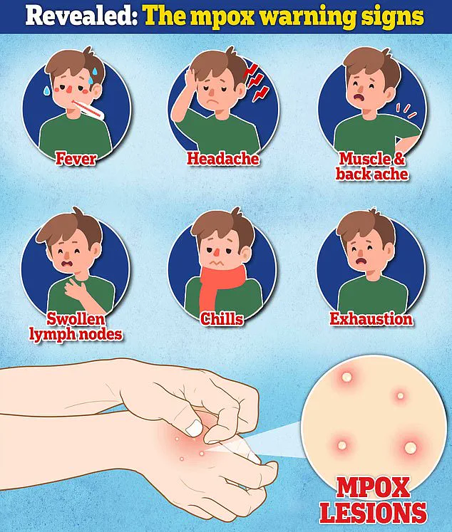 Urgent: First Mpox Case in Alaska Since 2023 Linked to Travel to Endemic Region – Health Officials Issue Advisory