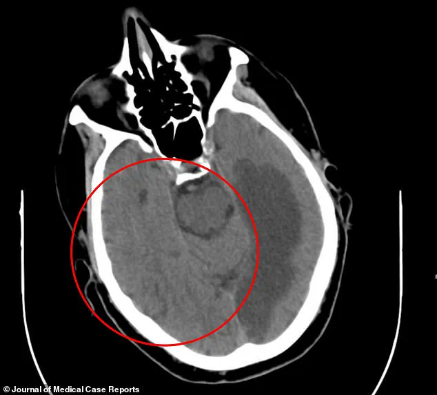Urgent Medical Mystery: 76-Year-Old Man in Waterford, Ireland's Bizarre Symptoms Stun Global Neurologists