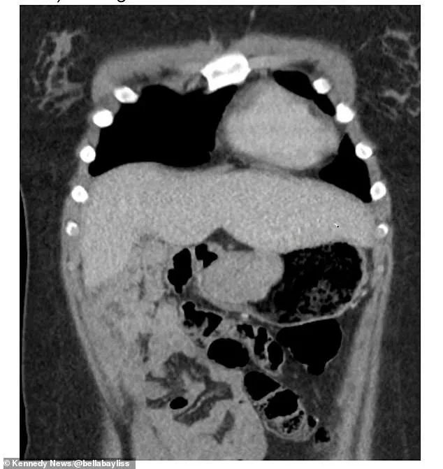 Bella Bayliss's Case Highlights Gaps in Healthcare Regulations