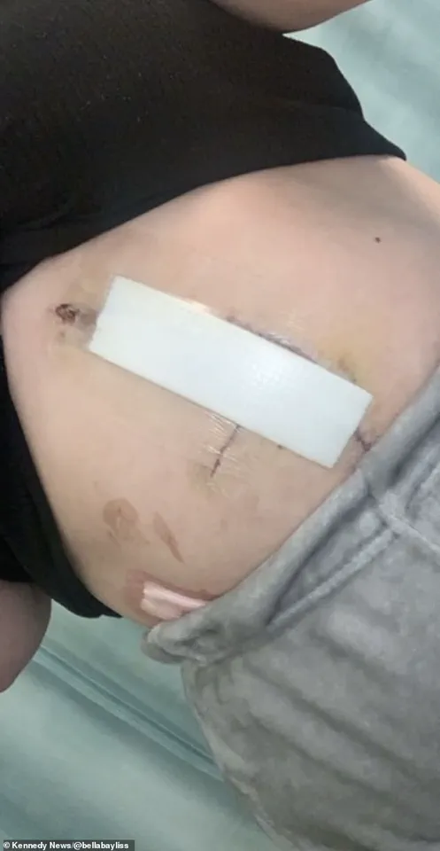 Bella Bayliss's Case Highlights Gaps in Healthcare Regulations