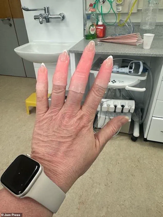 Controversy Over Delayed Medical Intervention for Swansea Woman with Recurring Kidney Stones