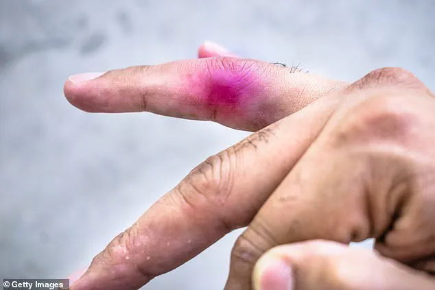 Civil Lawsuit Between Minors Over Daycare Injury Sparks Legal Debate