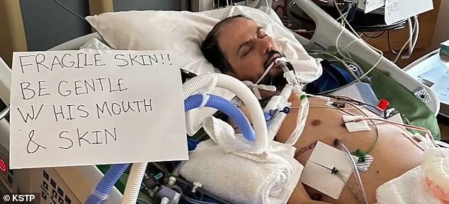 Imminent Deportation Threatens Life of Hani Duklef, Libyan Immigrant with Rare Genetic Skin Disorder Facing Death Sentence in Libya