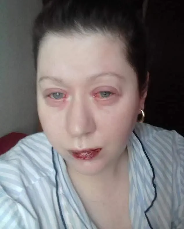 A Routine Choice with Unforeseen Consequences: Jo Daniels on Benylin's Life-Changing Impact