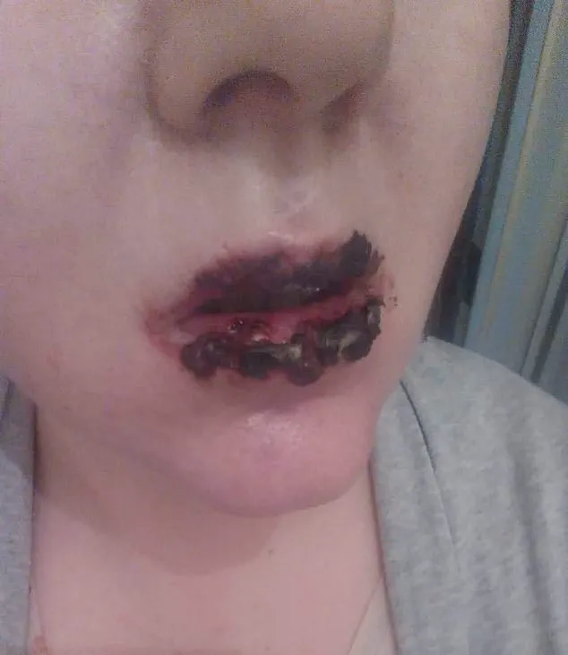 A Routine Choice with Unforeseen Consequences: Jo Daniels on Benylin's Life-Changing Impact