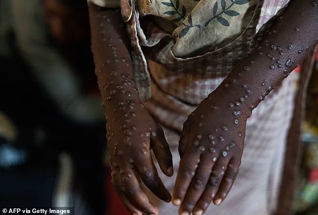 Climate Change and Human Expansion Fuel Emerging Viral Threats