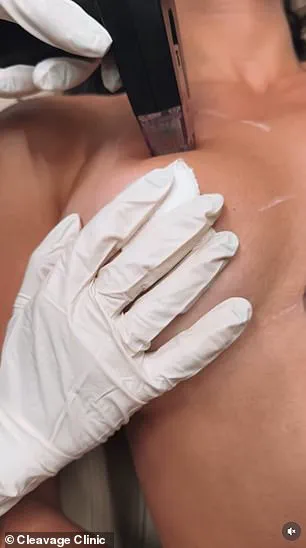 Exclusive Access: How a NYC Clinic is Revolutionizing Non-Invasive Breast Enhancements for Privileged Few