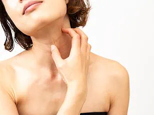 Eczema and Its Lifelong Impact: A Personal Story