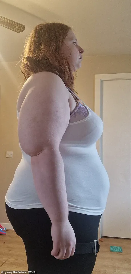 Lynsey Macfadyen's Daily Meal Ritual: Super Noodles, Buttered Bread, and the Influence of Hormonal Contraception on Appetite