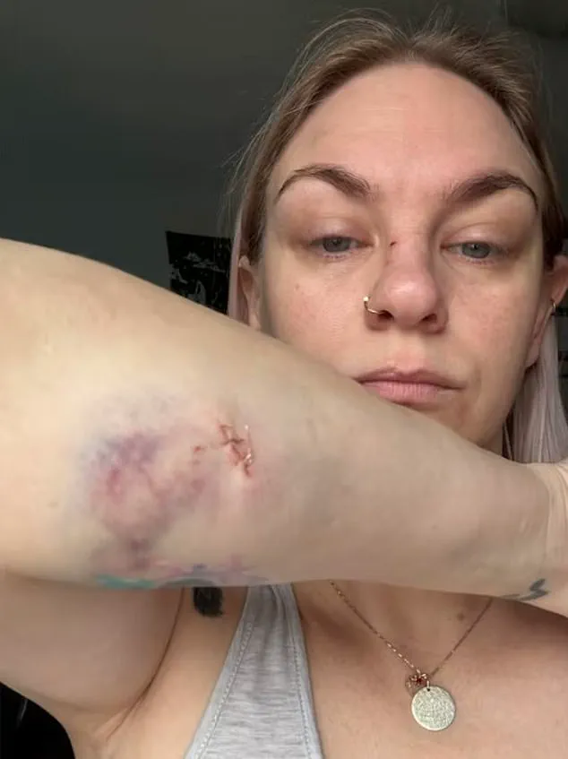 Oshawa Dog Attack Injures Three, Igniting Debate Over Pet Ownership and Safety Laws