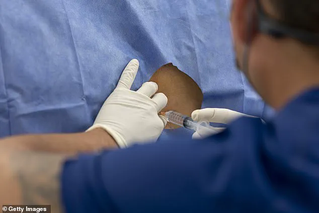 Antibiotic Gel Injection Cuts Chronic Back Pain by Over 50% in Groundbreaking Study