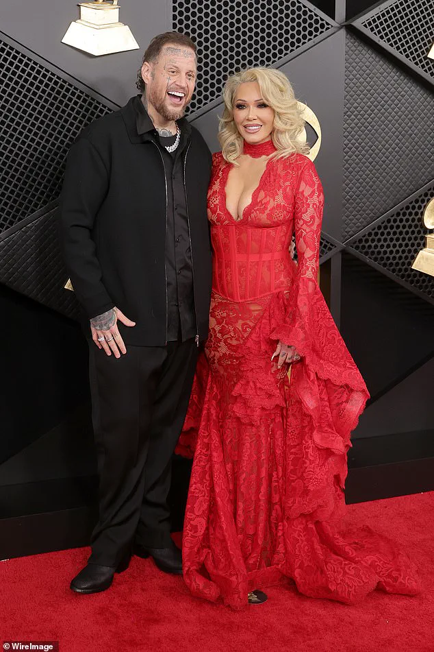 Jelly Roll's 300lb Weight Loss: Lifestyle Changes Spark National Conversation on Sustainable Methods