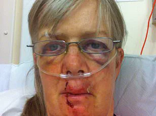 Dog Walker Climbs Tree to Escape Angry Cow, Firefighters Called to Isle of Wight Scene