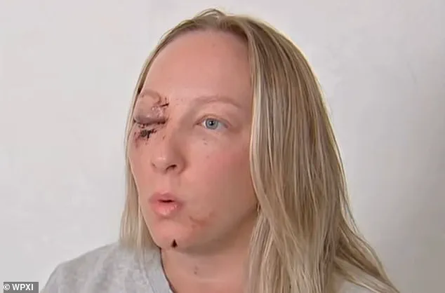 Truck Ice Chunk Injures Pennsylvania Mother, Daughter in Shock as Windshield Shatters