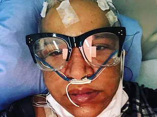 Study Reveals Long Covid Linked to Increased Dementia Risk in 20 Million Americans