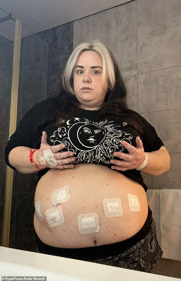 Katie Newell's Remarkable Transformation: A Beacon of Hope in the UK's Obesity Crisis