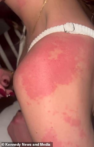 Mercedes Brooke's Health Crisis: From Hair Loss to Life-Threatening Symptoms