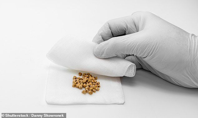 Daily Cheese Intake Linked to 26% Lower Risk of Gallstones, Study Finds