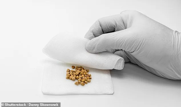 Daily Cheese Intake Linked to 26% Lower Risk of Gallstones, Study Finds