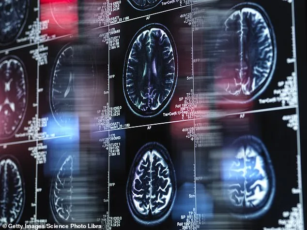 UK Dementia Cases Reach Half a Million, Young-Onset Cases on the Rise