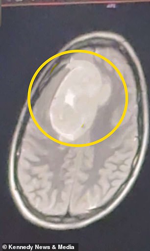 From Dismissal to Discovery: Gillian Keating's Battle with Unseen Pain