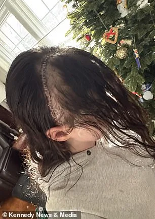 From Dismissal to Discovery: Gillian Keating's Battle with Unseen Pain