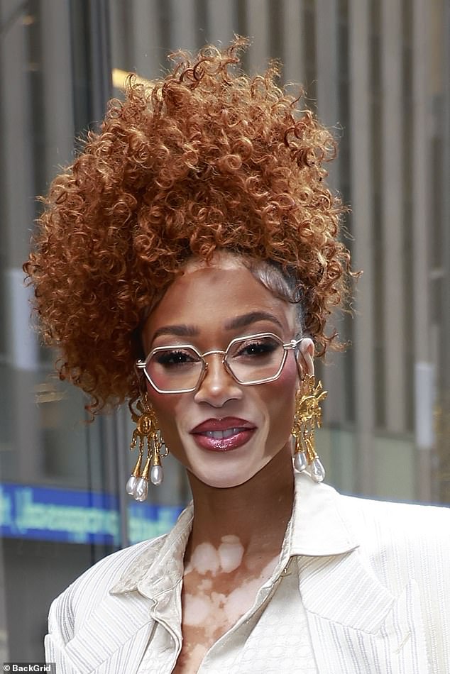 NHS Offers Groundbreaking Vitiligo Cream to Restore Pigmentation for 100,000 Patients