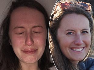 Double Vision: A Red Flag for Stroke, Brain Tumors, and Neurological Emergencies