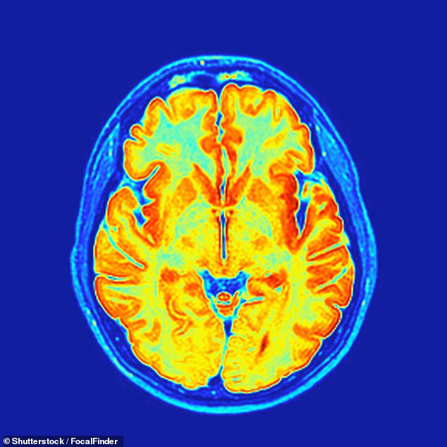 Groundbreaking Study Reveals 'Baby Brain' Is a Real Structural Brain Change Preparing for Parenthood