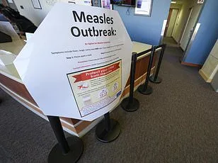 Measles Resurgence in US: SSPE and Unvaccinated Children Fuel Outbreak Concerns