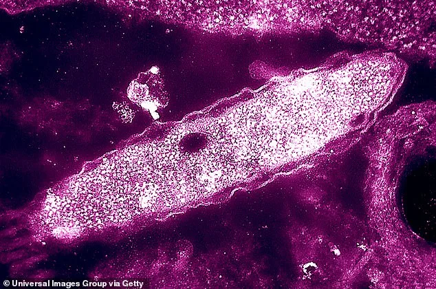 UKHSA Investigates Legionnaires' Disease Cluster in London