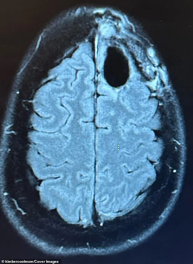 Kimberly Pelling's Defiant Battle Against Rare Brain Cancer: A Mother's Journey Through Aggressive Treatment and Uncertain Prognosis