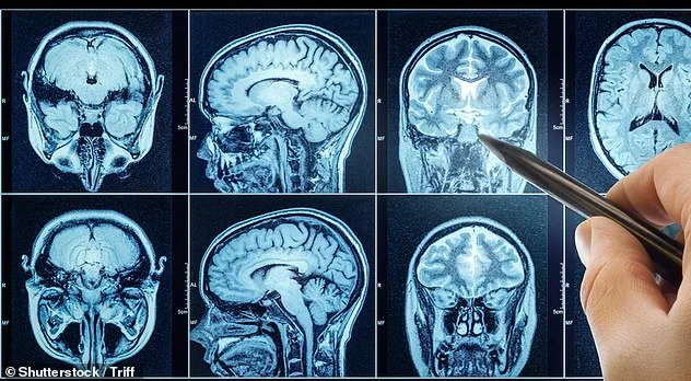 Long-Buried Cold War Secret and a Forgotten Drug: Mebendazole's Surprising Cancer Cure Potential