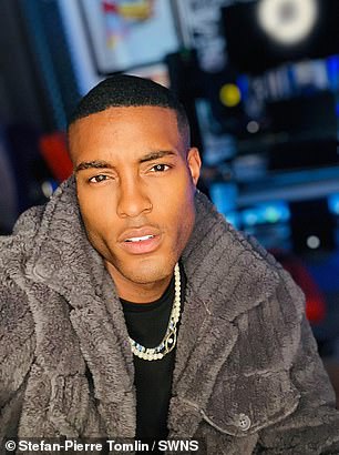 From Lies to Liberation: A Model's Decade-Long Battle with Baldness and a £5,000 Hair Transplant