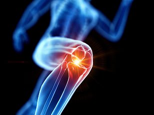 Groundbreaking Study Reveals Inexpensive Prebiotic Could Transform Osteoarthritis Care