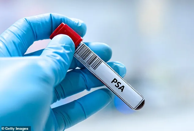 Cheap Diabetes Drug Metformin May Cut Prostate Cancer Risk by Over a Third, Study Suggests