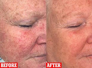 From Rash to Reality: The Misunderstood Severity of Chronic Skin Conditions