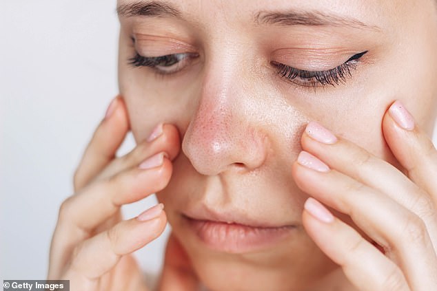 Woman's Nose Remains Cold Despite Warmth: Unusual Raynaud's Case