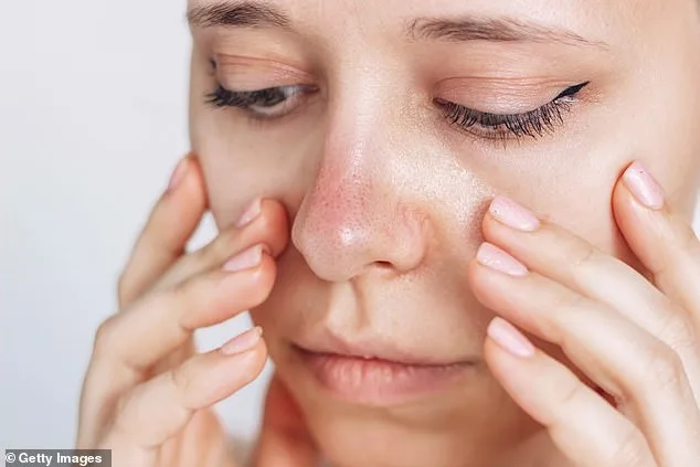 Woman's Nose Remains Cold Despite Warmth: Unusual Raynaud's Case
